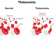 BÁC SĨ CHỈ CÁCH TRÁNH CHO CON BẠN KHÔNG BỊ BỆNH TAN MÁU BẨM SINH THALASSEMIA